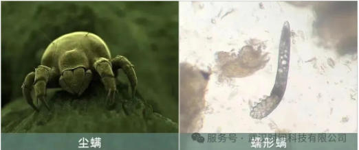 防螨！已成為健康的&ldquo;新剛需&rdquo;--武漢時(shí)間科技推出紡織品防螨整理劑喜化&reg;植螨零